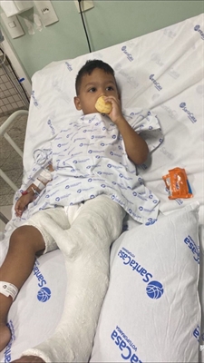 Bryan Vinícius, de apenas 3 anos, caiu e fraturou o fêmur; acidente doméstico ocorre no Pró-Povo. ( Foto: Arquivo pessoal)