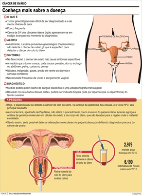 Exame ginecológico periódico poderá identificar câncer de ovário