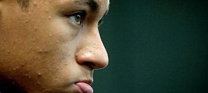 Santos enfrenta o Once Caldas na Colômbia