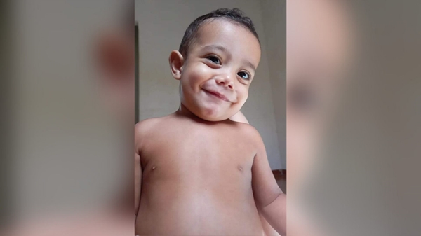 O pequeno Heitor Raphael, de pouco mais de um ano, foi atropelado recentemente e a família faz uma ‘vaquinha’ on-line para ajudar nos custos (Foto: Arquivo pessoal)