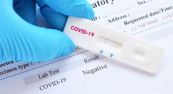 A testagem em massa é um dos mecanismos mais importantes para reduzir a velocidade de contágio do coronavírus (Foto: Reprodução/PFarma)