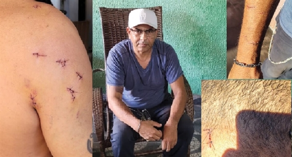 Dois adolescentes deram pelo menos 12 golpes de canivete em Marcelo Fernandes, de 56 anos (Foto: A Cidade)