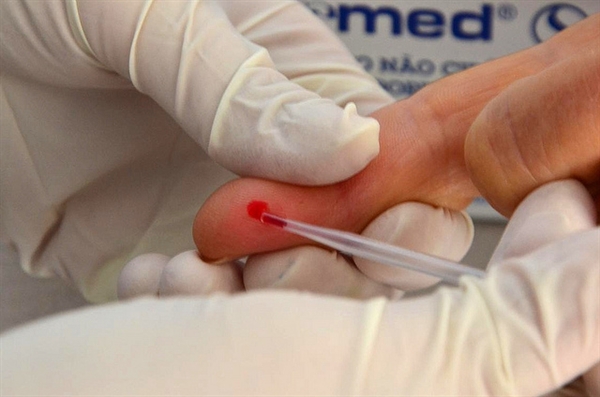 Saúde, Rotary e Unifev promovem campanha para detectar hepatite em Votuporanga