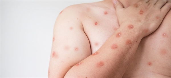 Foto: Divulgação/Ministério da Saúde