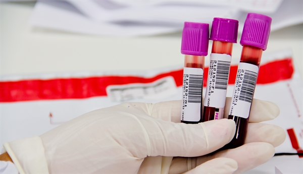 H1N1 não foi a causa da morte de homem em Votuporanga