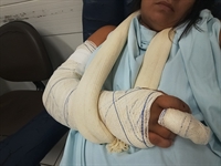 Após sofrer sério acidente de trânsito, votuporanguense pede a ajuda da população