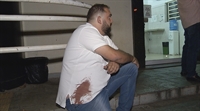  Sangue na camisa de homem que foi ao plantão registrar boletim (Foto: Reprodução/TV TEM) 