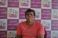 Ronaldo Santana Santos é portador de xeroderma pigmentosum, uma doença rara e que provoca feridas na pele (Foto: A Cidade)