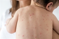 Em outubro, a ação será voltada para crianças de seis meses a menores de cinco anos de idade (Foto: Reprodução)