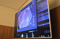 (Foto: Reprodução/CordVida/ Ultrassom Gestacional)
