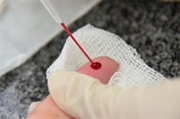 Durante os cinco dias, todas as unidades de saúde e a Coordenação Municipal IST/Aids oferecerão testes rápidos e gratuitos de HIV e sífilis (Foto: Divulgação/Prefeitura de Votuporanga)